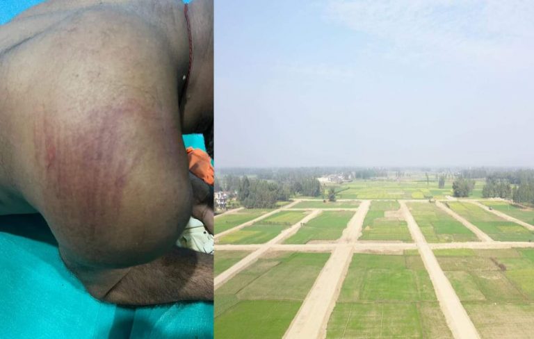 रौतहटको माैलापुर लैण्डपुलिङ्गकाे काम राेक्ने विकास विराेधीहरू लाई कार्यवाही गर्न जाेडदार माग