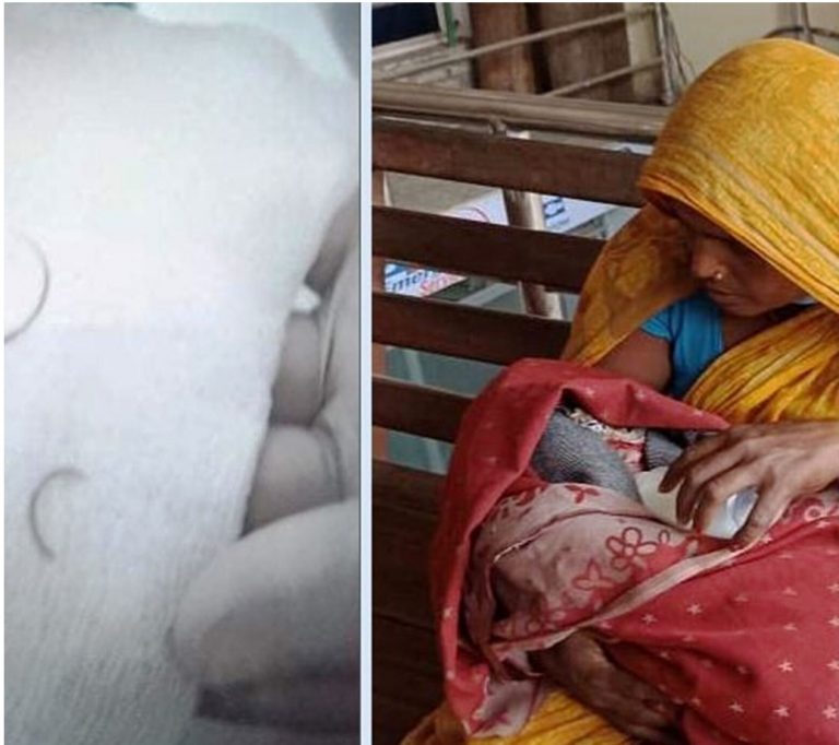 चिकित्सकले स्टीच लगाउने क्रममा योनिद्धारमै सियो भाँचिएको घटना सार्वजनिक